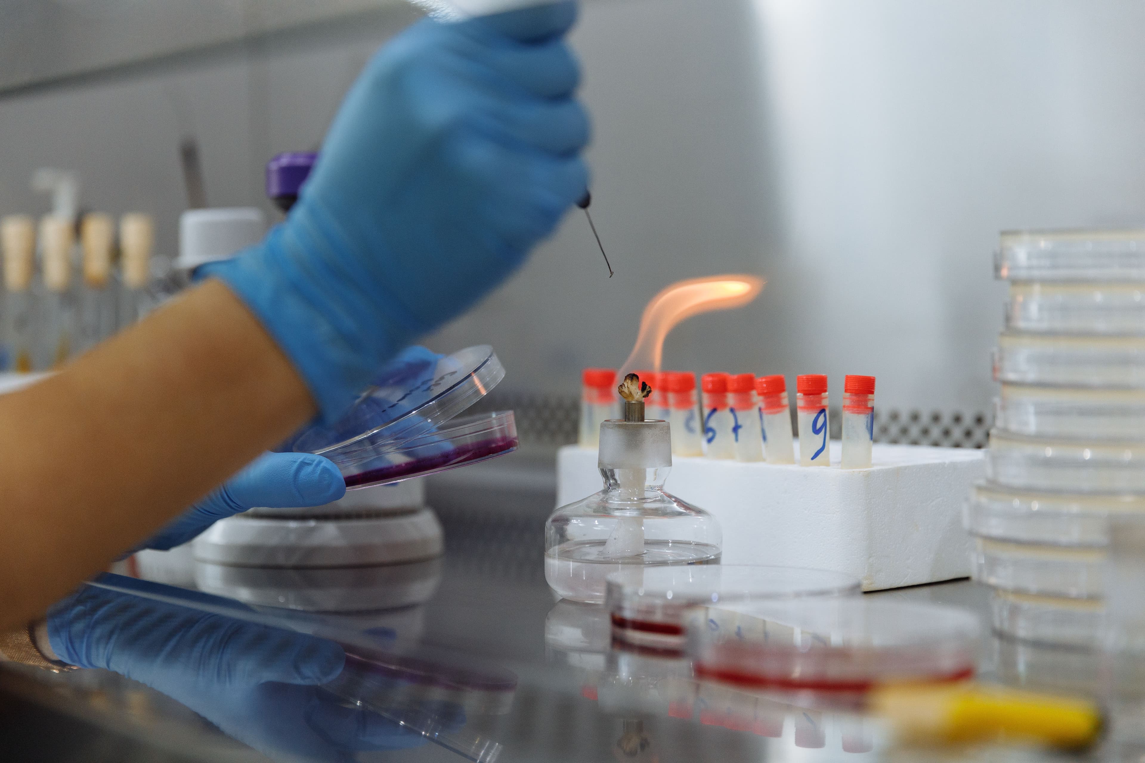 Bioburden & Microbial Limits Testing